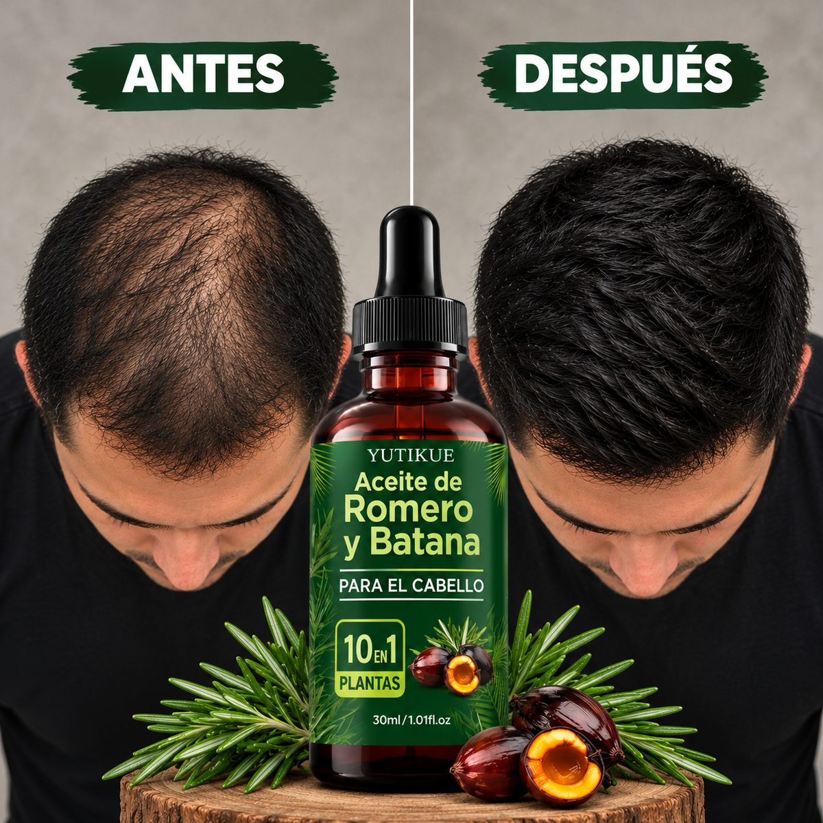 Aceite Crece Pelo para hombre de Romero